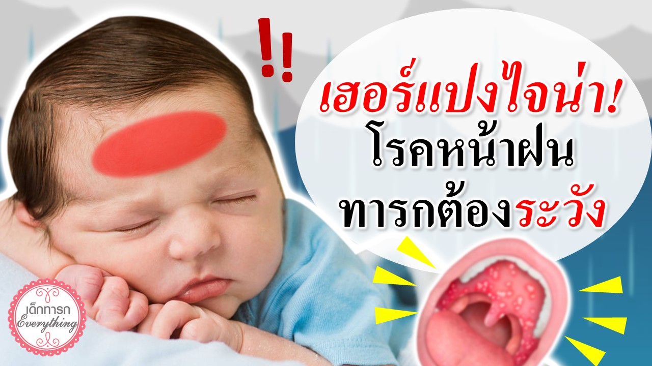 "เฮอร์แปงใจน่า" โรคหน้าฝนที่ทารกต้องระวัง!