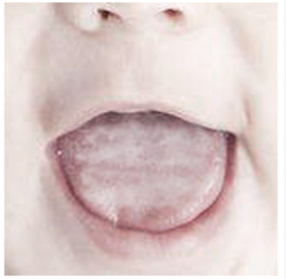 ผ้าเช็ดลิ้นทารก 0-6 เดือน