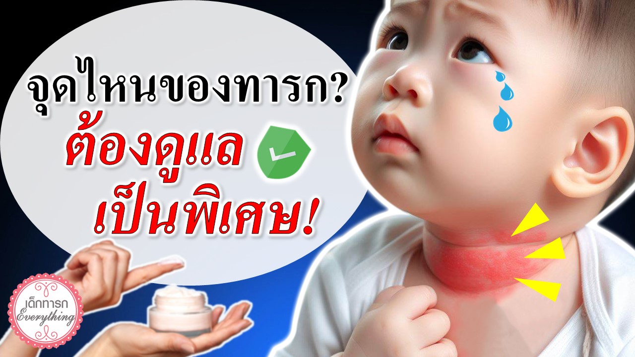 จุดไหนในทารกต้องดูแลเป็นพิเศษ ?