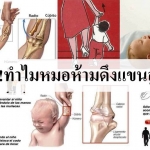 อันตราย! ทำไมหมอถึงห้ามดึงแขนลูกแบบนี้ มาดูกัน