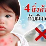 วิธีเลี้ยงเด็กทารก : 4 เรื่องห้ามทำกับผิวทารก! (ผิวเด็กทารก)