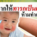 ไม่อยากให้ทารกเป็นผื่น ห้ามทำแบบนี้