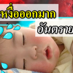 เด็กทารกเหงื่อออกมาก อันตรายไหม